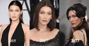 Bella Hadid Plastic Surgery