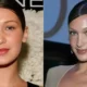 Bella Hadid Plastic Surgery